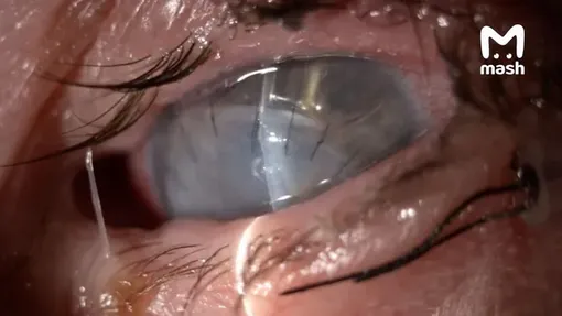 Инна Борода практически полностью потеряла зрение