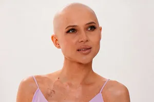 «Удивляться тут нечему»: онколог Черемушкин оценил возвращение Лерчек к танцам при четвертой стадии рака с метастазами