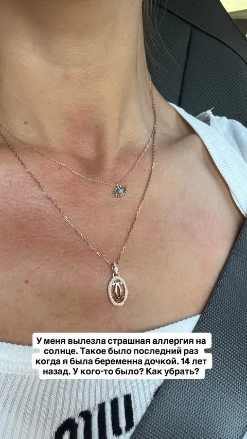 Виктория Боня столкнулась с аллергией Виктория Боня столкнулась с аллергией