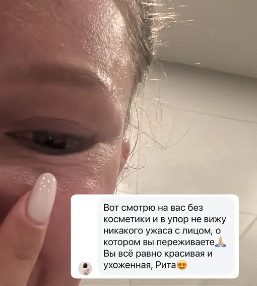 Рита Дакота страдает из-за неудачной пластики Рита Дакота страдает из-за неудачной пластики