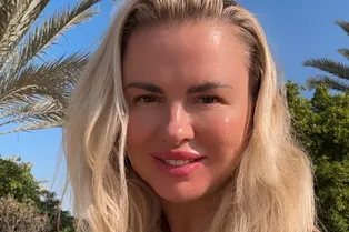 «Подружки в диком восторге. Лосось — молодец!»: Анна Семенович сделала модные уколы красоты