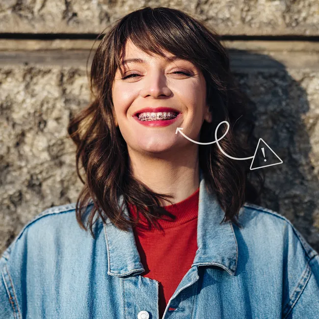 Обратная сторона брекетов: почему выпрямление зубов может испортить черты лица и как этого избежать