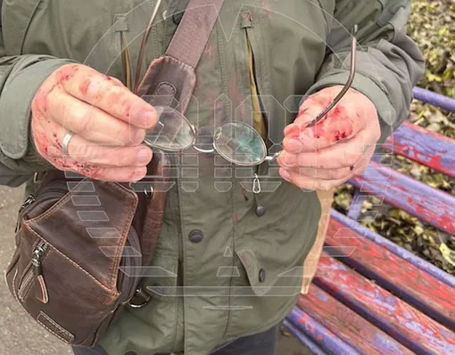 Игорь Кулинич написал заявление на соседок