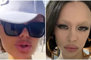 «Это начинает меня напрягать»: Викторию Боню огорчило то, что ее после операции сравнили с Инстасамкой «Это начинает меня напрягать»: Викторию Боню огорчило то, что ее после операции сравнили с Инстасамкой