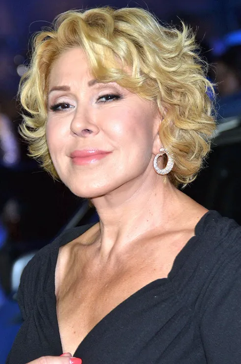 Российские знаменитости после пластики