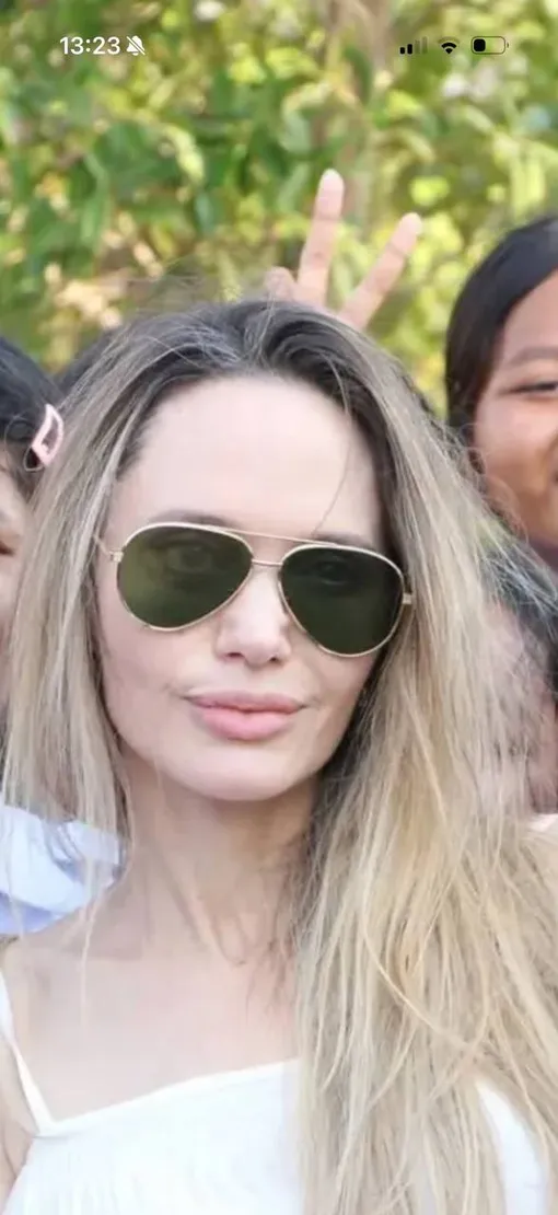 Анджелина Джоли после пластической операции