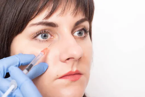 Как убрать синяки под глазами после новогодних праздников? Как убрать синяки под глазами после новогодних праздников?