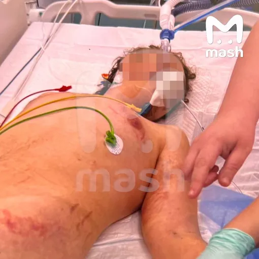 Рома находится в реанимации