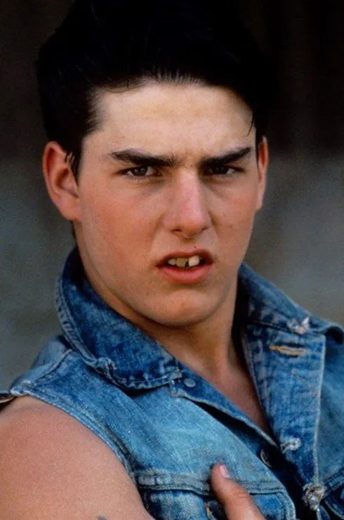 виниры у звезд фото