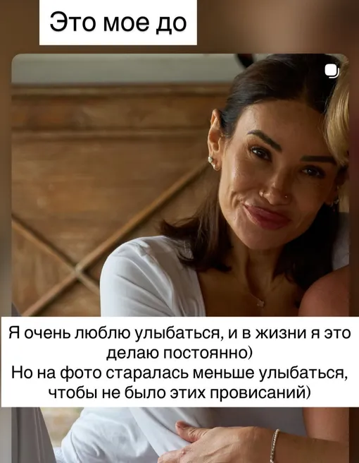 Айза до пластики