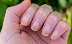 9 причин, по которым ногти становятся желтыми, и что делать в каждом случае
