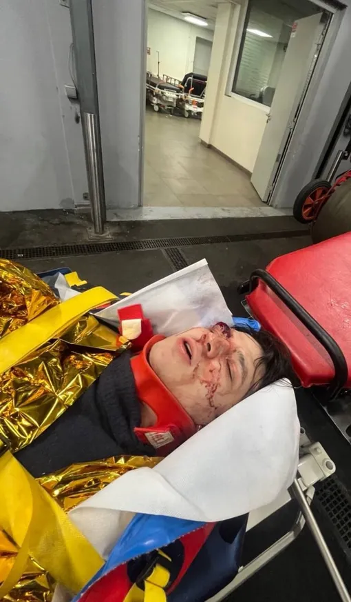 Рэпер Vacio выпал из третьего этажа в Париже