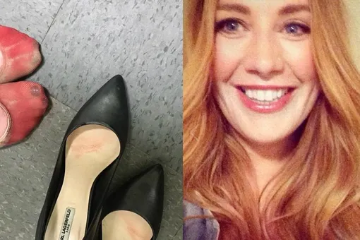 Официантка из Канады показала кровавые мозоли, до которых ее доводит работа Официантка из Канады показала кровавые мозоли, до которых ее доводит работа