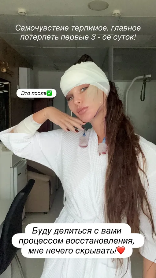 Светлана Сильваши сделала эндоскопию лица