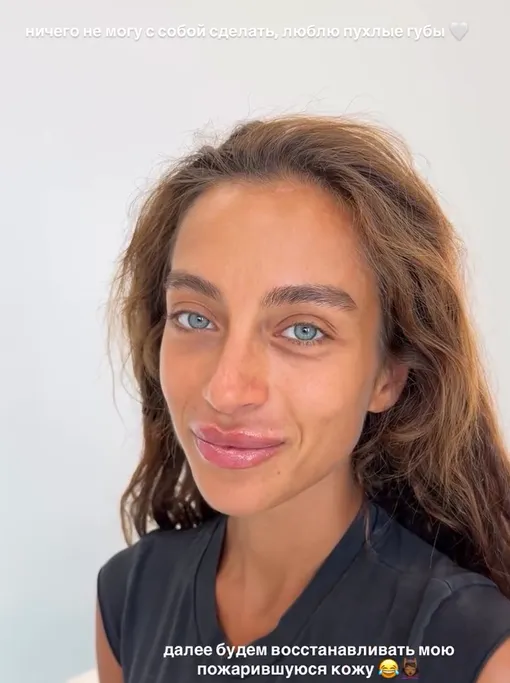Ангелина Суркова после процедуры Ангелина Суркова после процедуры