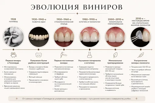 Эволюция виниров: все этапы развития в одной инфографике. что делать если темнеют зубы