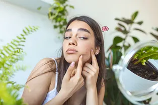 Как замазать надоевшие прыщи без тонны консилера: этот продукт реально работает! Как замазать надоевшие прыщи без тонны консилера: этот продукт реально работает!