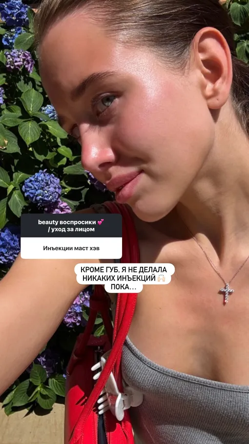 Аврора Киба не стала скрывать, что увеличила губы