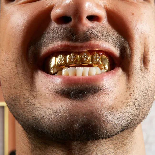 Подточить клыки, установить камеру: странные запросы пациентов стоматолога