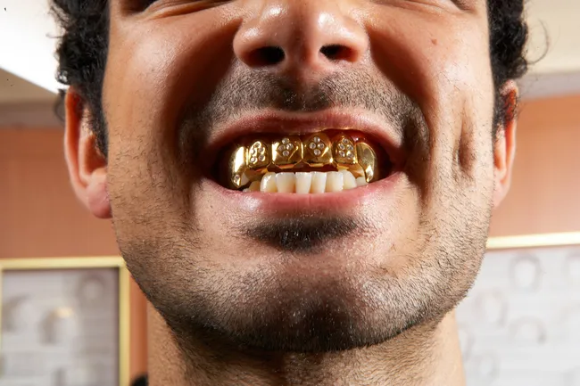 Подточить клыки, установить камеру: странные запросы пациентов стоматолога