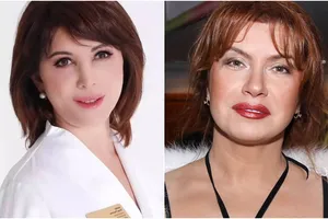 Обидевшаяся на Веру Сотникову косметолог показала, как выглядела актриса до и после процедуры