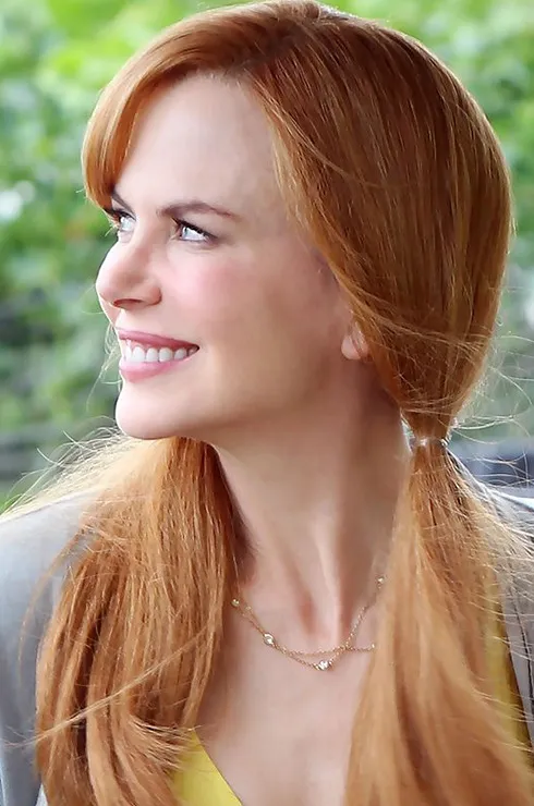 виниры у звезд фото