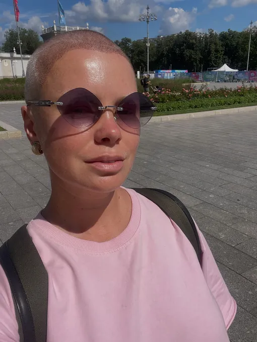 Евгения Осипова перенесла пересадку волос Евгения Осипова перенесла пересадку волос
