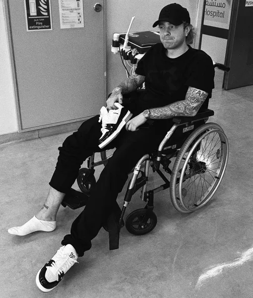 Егор Крид травмировал ногу Егор Крид травмировал ногу