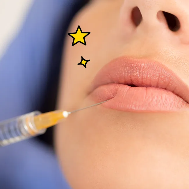 «Сколько раз в жизни можно увеличивать губы?»: 5 самых частых вопросов косметологу о популярной процедуре