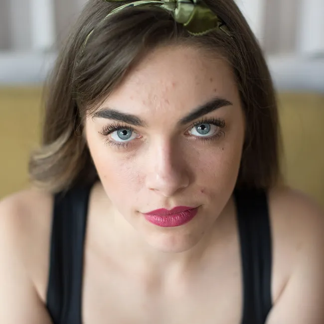 Как избавиться от прыщей навсегда