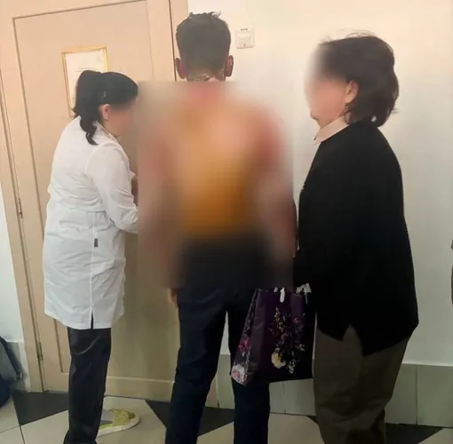 У одного из пострадавших мальчиков 50% ожогов всего тела У одного из пострадавших мальчиков 50% ожогов всего тела