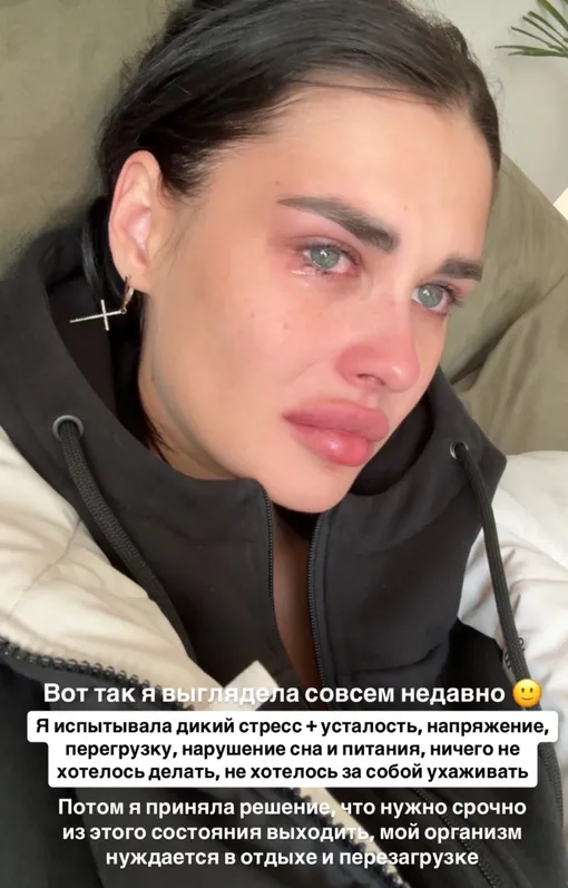 Ирина Пинчук пережила сильный стресс