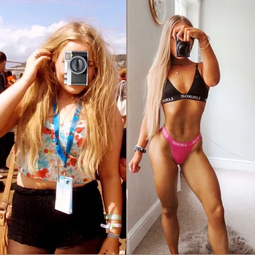 Британка страдала от комплексов и травли сверстников Британка страдала от комплексов и травли сверстников