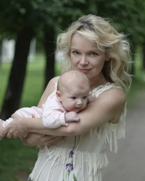 Виталина Цымбалюк-Романовская сделала пластику перед родами