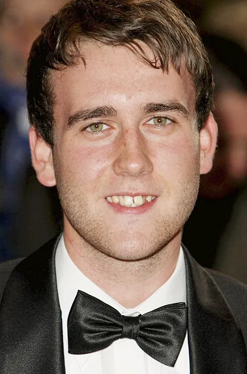 виниры у звезд до и после