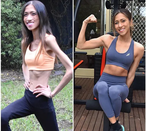 Сара Рав победила анорексию и стала мотиватором для других