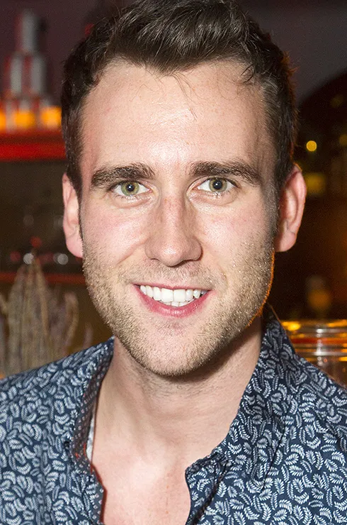 виниры у звезд до и после