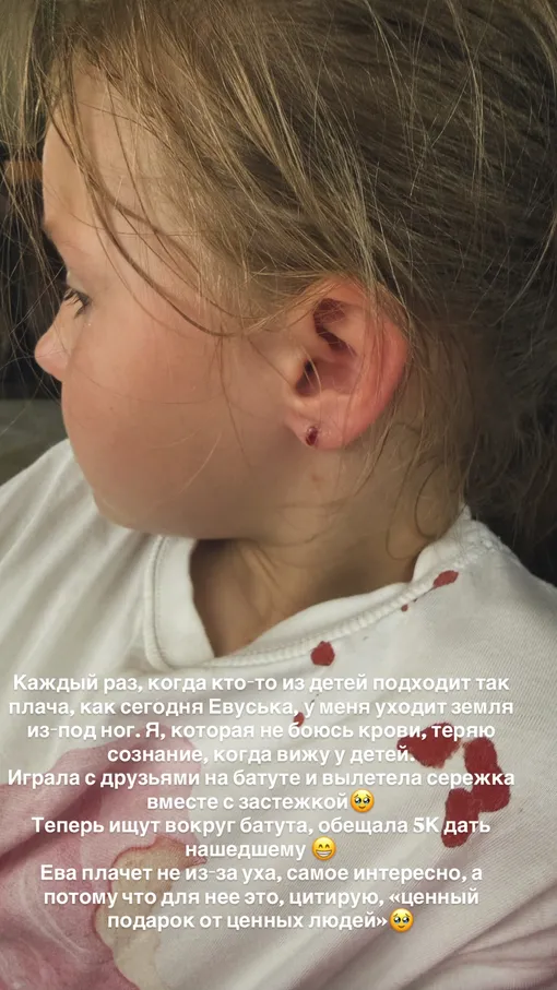 Ева травмировала ухо Ева травмировала ухо