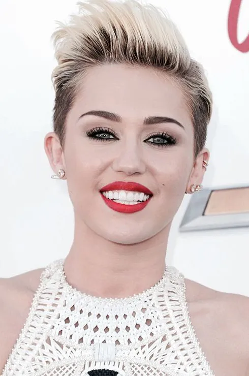 виниры у звезд фото до и после