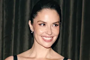 «Неприятно, как будто у меня огромные веснушки»: Агата Муцениеце показала лицо после уколов с биоматериалом лосося