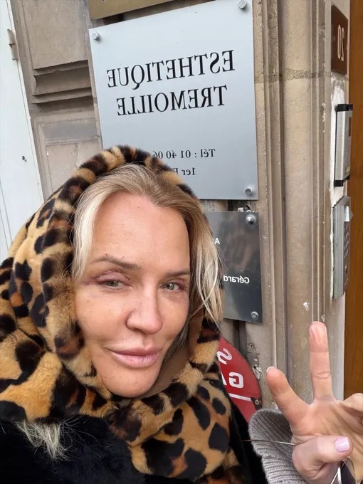 Виктория Шелягова сделала пластическую операцию в Париже