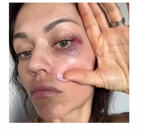 Звезда соцсетей подверглась избиению и сняла побои