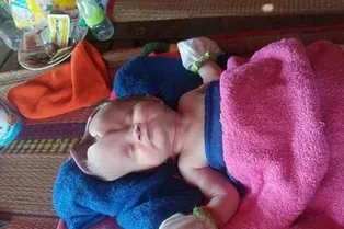 Родители девочки с провалом в черепе не теряют надежды ее спасти Родители девочки с провалом в черепе не теряют надежды ее спасти