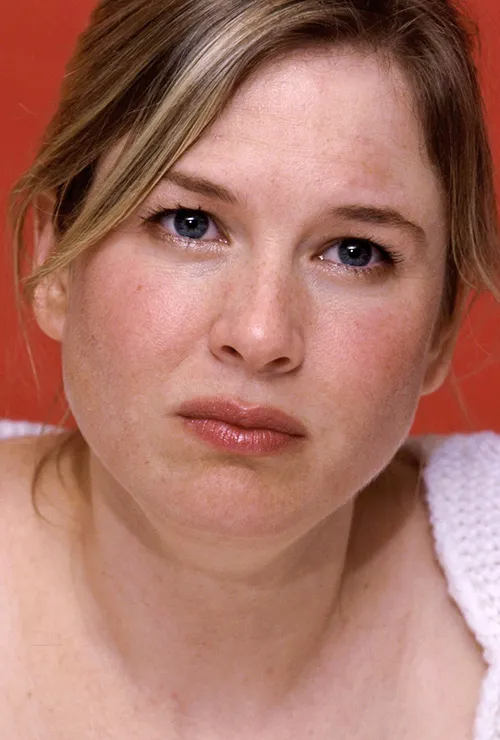 звезды сделавшие блефаропластику до и после