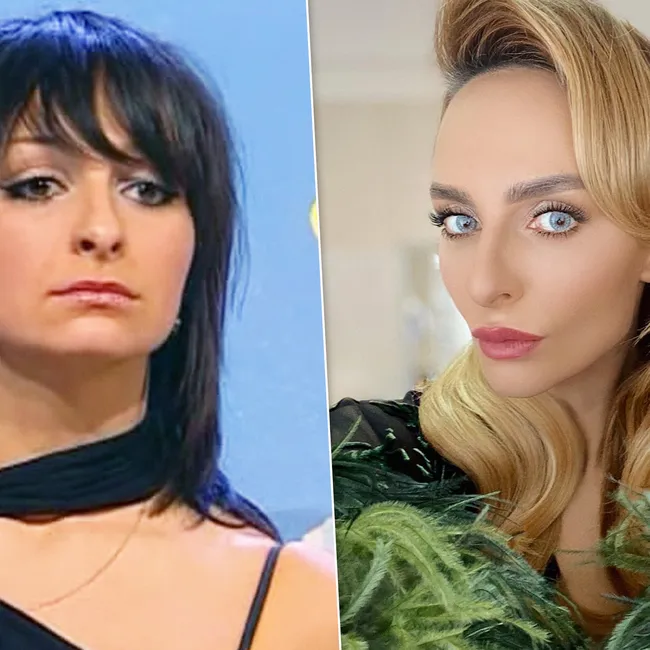 Цена красоты: сколько стоит лицо Екатерины Варнавы — рассказывает хирург