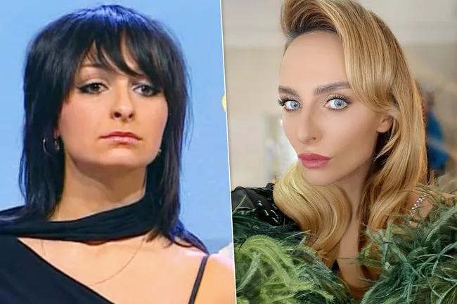 Цена красоты: сколько стоит лицо Екатерины Варнавы — рассказывает хирург