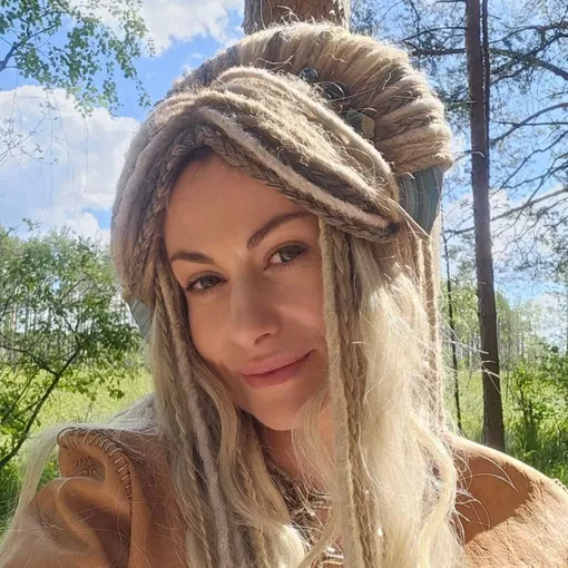 Анна Ковальчук рассказала о пластике Анна Ковальчук рассказала о пластике