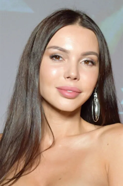 звезды губы до и после