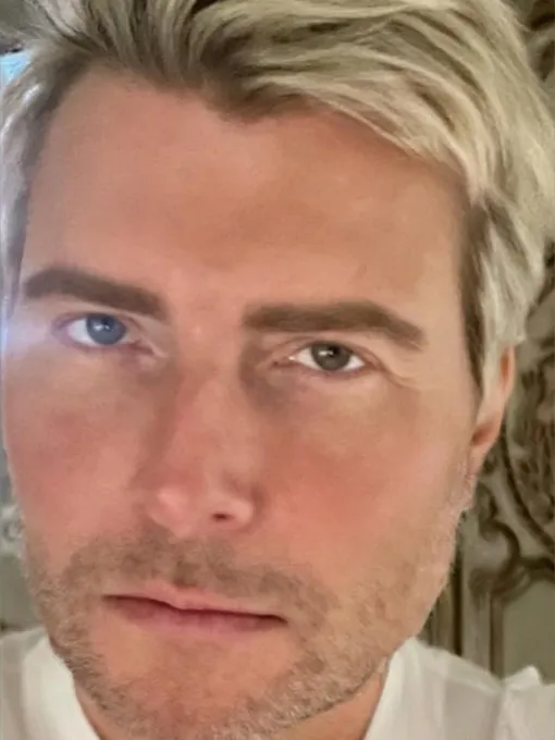 Николай Басков заявил, что у него глаза разного цвета