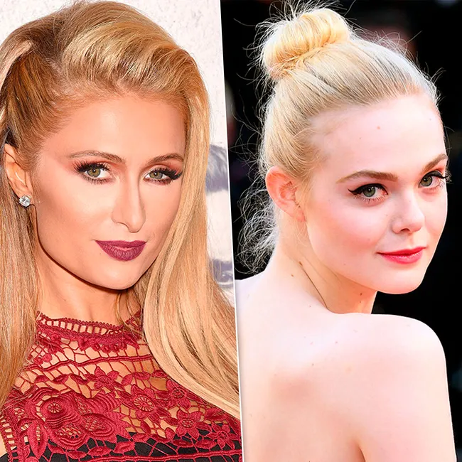 Пэрис Хилтон и другие звезды, удалившие зубы мудрости ради выразительных скул